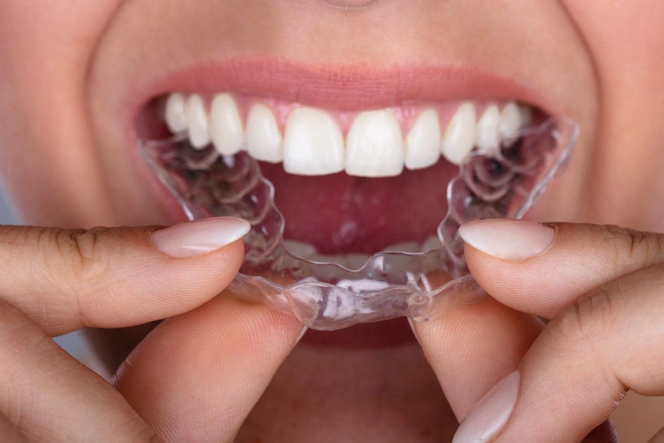 Affordable Invisalign Near Me Lawrence, NY