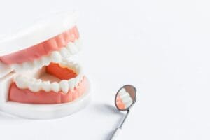 Problems with Crooked Teeth