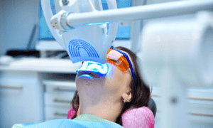 The Ultimate Guide to Teeth Whitening in Clinton, MD
